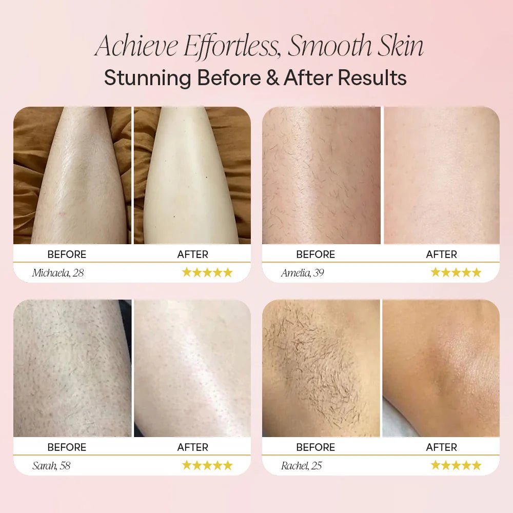 Nuri™ Trimmer 2.0 - Elanuri