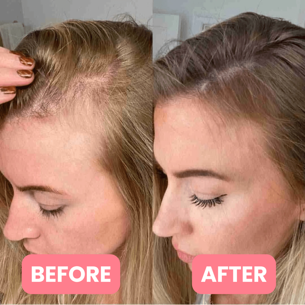 Nuri™ 4 in 1 Hair Therapy Brush - Elanuri